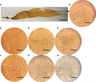 Epimicrobiome Shifts With Bleaching Disease Progression in the Brown Seaweed Saccharina japonica